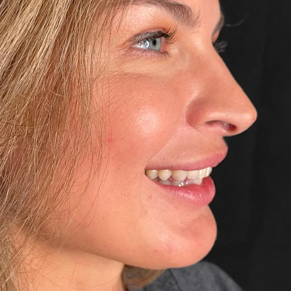 Yaya antes de colocarle carillas